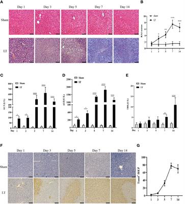 Neutrophil Extracellular Traps Regulate HMGB1 Translocation and Kupffer Cell M1 Polarization During Acute Liver Transplantation Rejection